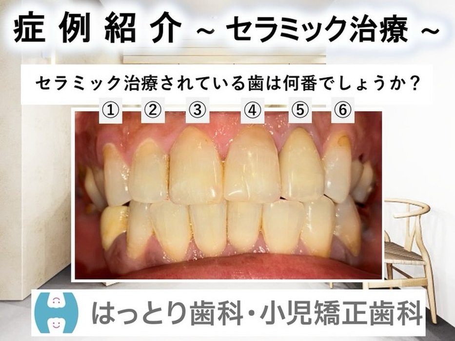 画像285