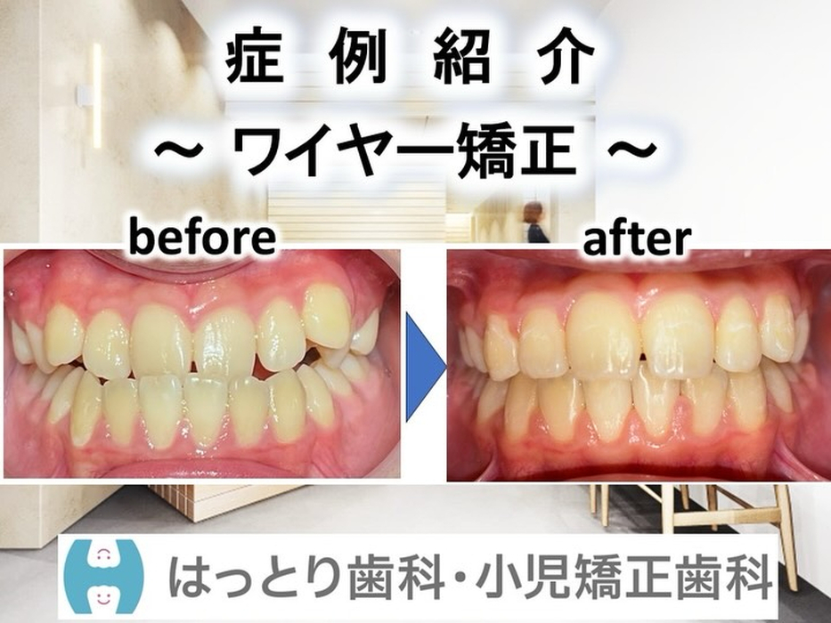画像290