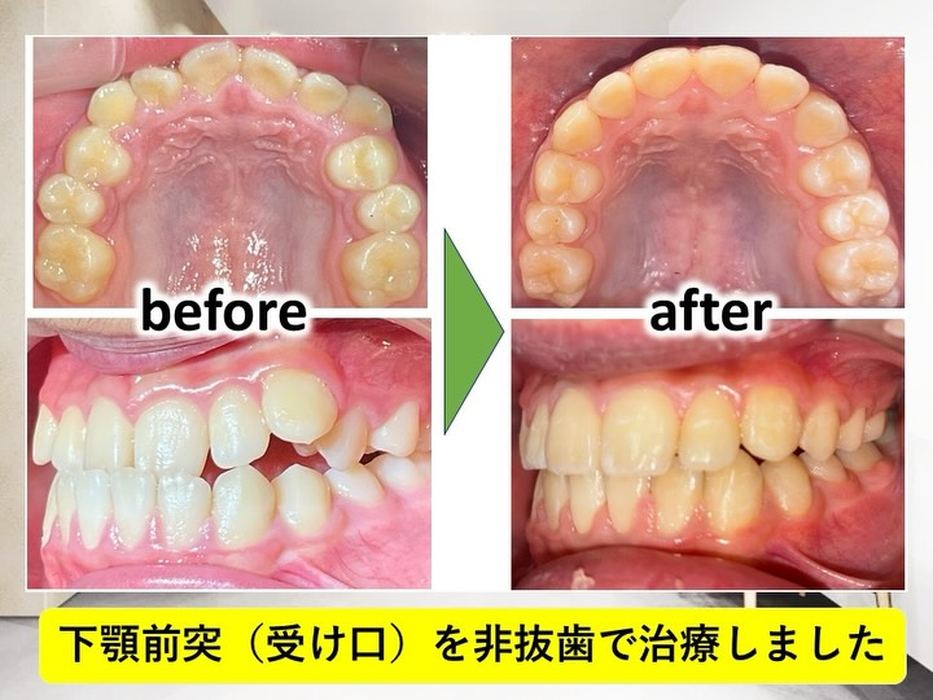 画像291
