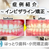 画像306