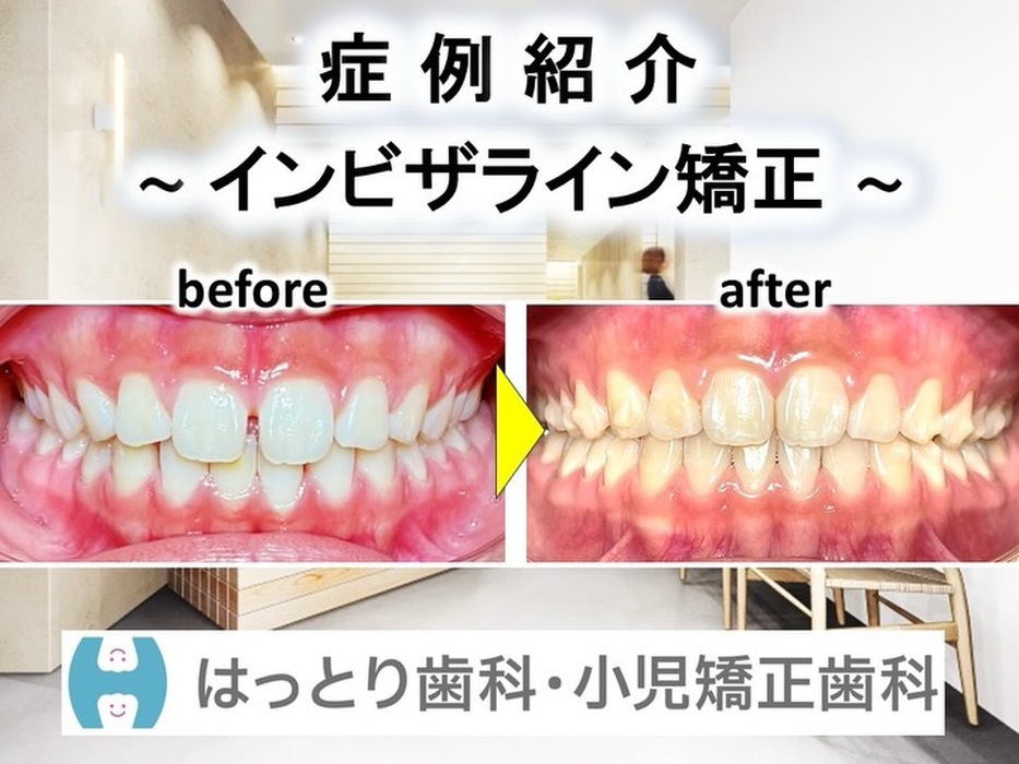 画像306